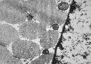 F,32y. | transversally sectioned skeletal muscle cell